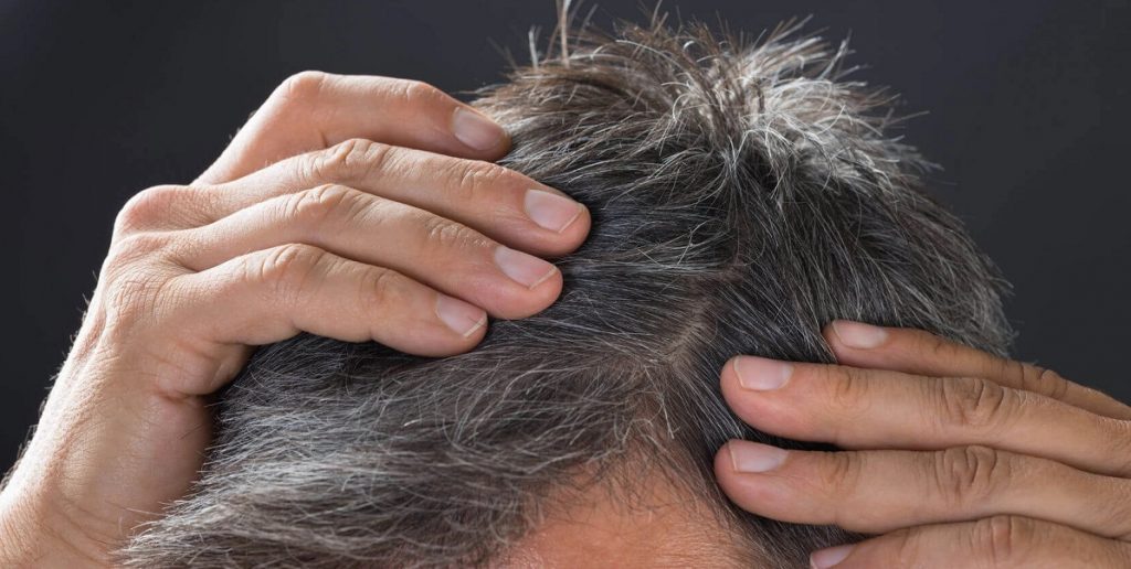 Wetenschappers komen steeds een stap dichterbij een remedie voor grijze haren