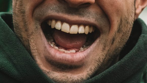 De 5 grootste oorzaken van gele tanden