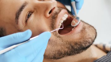 Een trucje om zelf je tanden te bleken gaat viral op TikTok