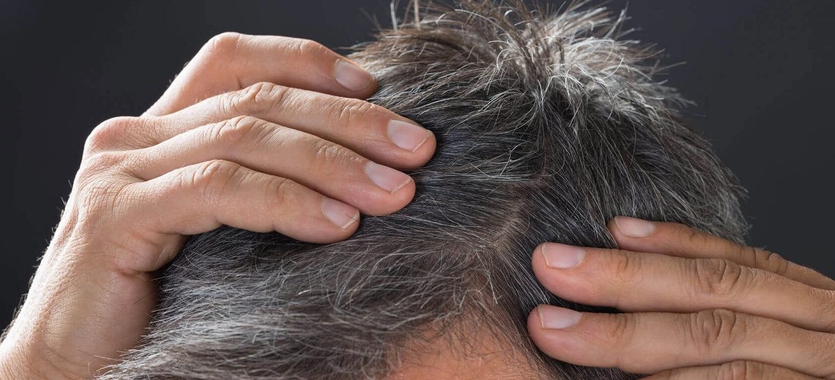 Wetenschappers komen een stap dichterbij een remedie tegen grijze haren