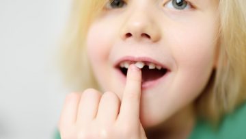 Op welke leeftijd begint een kind met tanden wisselen?